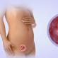 Когда появляются первые признаки беременности после зачатия Через какое время начинаются симптомы беременности